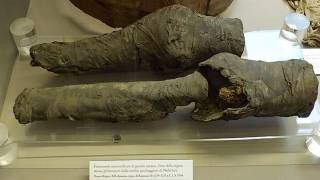 Study: 3,200-yo Set of Mummified Legs Belonged to Queen Nefertari