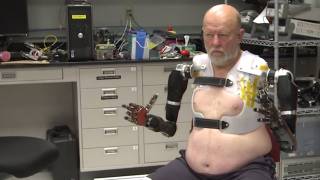 A taste of the future: Double amputee controls two bionic arms at the same time