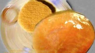 Scientists Flesh Out Plans to Grow (and Sell) Test Tube Meat