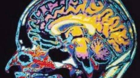 Court to Defendant: Stop Blasting That Man’s Mind!