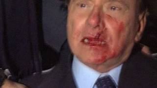 Berlusconi attacked, struck in face at rally (Video)