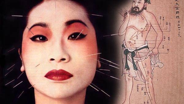 The point about pain: New study sheds light on acupuncture