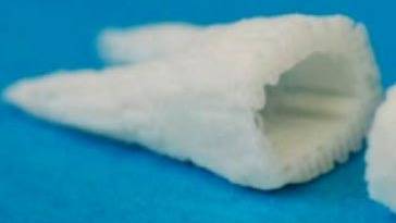 Body’s Own Stem Cells Can Lead to Tooth Regeneration