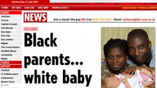 Genetic Mystery: Black Brits Birth White, Blue-Eyed Baby