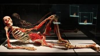 ’Our Body’ exhibition banned in France