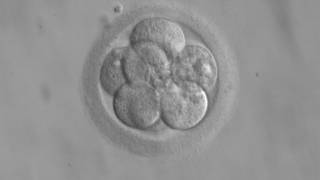Baby Born From 20-Year-Old Frozen Embryo