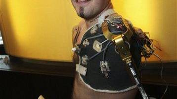 Austrian with high-tech robot arm dies after crash