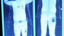 "World terror watch lists flawed" -Biometrics will 'help tighten up the system'.