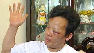 Police beat man first, ask questions later - but it's mistaken identity!