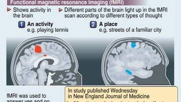 'Thought reading' brings hope for vegetative state patients