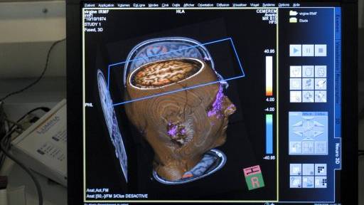 Are brains shrinking to make us smarter?