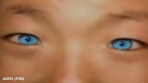 Does China’s Cat-Eyed Boy Really Have Night Vision?