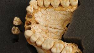 Neanderthals Found Certain Plants Important, Had Medicine