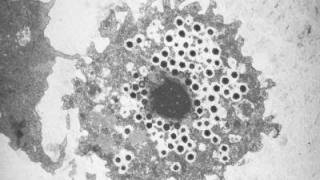 Giant Viruses Are Ancient Living Organisms, Study Suggests