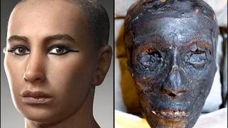 Mystery of King Tut’s death solved?