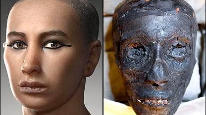 Mystery of King Tut’s death solved?