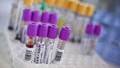 AIDS vaccine ’a step closer’ after HIV antibodies discovery