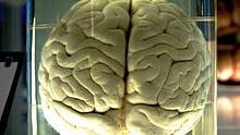 The Crack Team That Removes & Preserves People’s Brains Just Hours After They Die