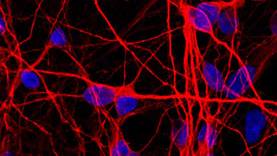 Brain Cells Made from Urine