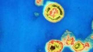 French scientists urge caution over HIV ’cure’