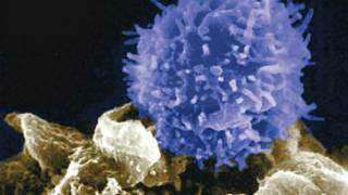 Scientists reprogram body’s own cells to kill cancer, HIV