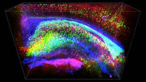 Stanford team creates transparent brain