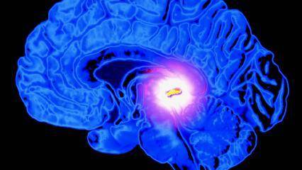 Mysteries Of The Pineal Gland