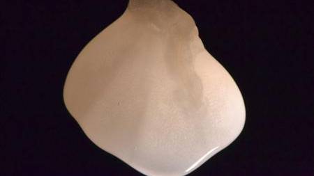 Lab-made kidneys raise hopes for dialysis patients