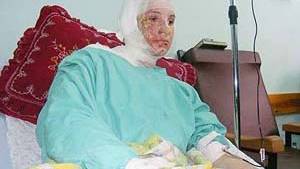 Israel gives up white phosphorus, because ’it doesn’t photograph well’