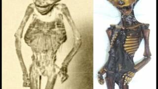 The Ata ’Alien’ Humanoid May Have An Earthling Cousin