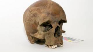 White man’s skull has Australians scratching heads