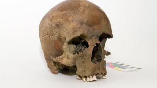 White man’s skull has Australians scratching heads