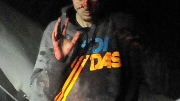 Dzhokar Tsarnaev’s Throat Wound: Another Government Lie Bites the Dust