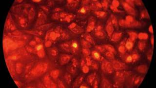 Controversial ’HeLa’ Cells: Use Restricted Under New Plan