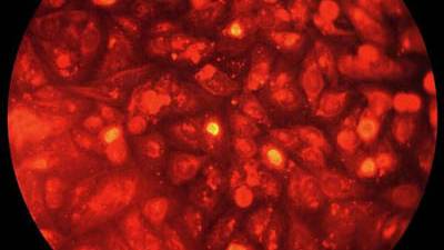 Controversial ’HeLa’ Cells: Use Restricted Under New Plan