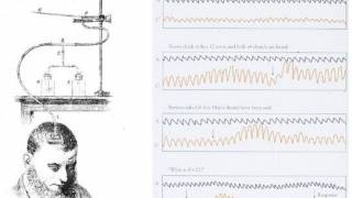 Science of the bloody brain