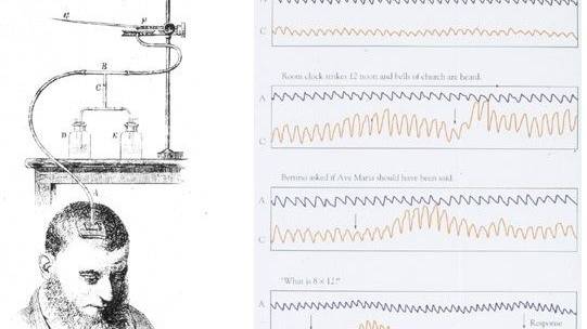 Science of the bloody brain