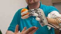 Man Gets First Prosthetic Hand That Can Feel