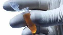 Sars Research Lab Loses 2,000 Tubes of Killer Virus