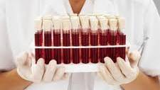 Man-Made Blood Might Be Used in Transfusions by 2016