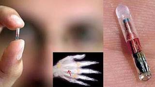 All Americans Will Receive A Microchip Implant In 2017 Per Obamacare