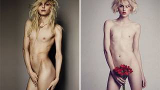 Transgender Activist Wants All Children Born Genderless