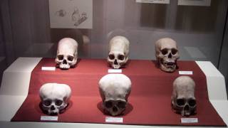 A Look at Theories About Elongated Skulls in Ancient Peru, Europe, Egypt