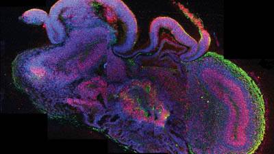 Whole organ ’grown’ in world first