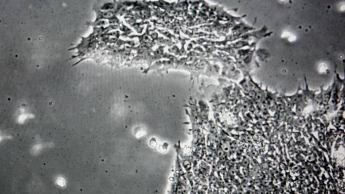 Virus that ’makes humans more stupid’ discovered