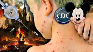 CDC Promotes Mandatory Vaccination Following Disneyland Measles "Outbreak"