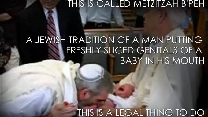 Orthodox Jews in talks with health officials over oral suction circumcision which has been linked to herpes in children