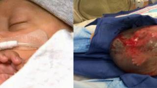 Baby born still INSIDE his amniotic sac is hailed a ‘medical miracle’ by doctors [Video]