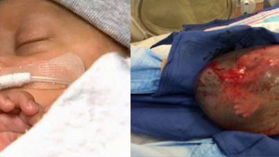 Baby born still INSIDE his amniotic sac is hailed a ‘medical miracle’ by doctors [Video]