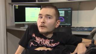 Revolutionary: Russian man to undergo first head-to-body transplant